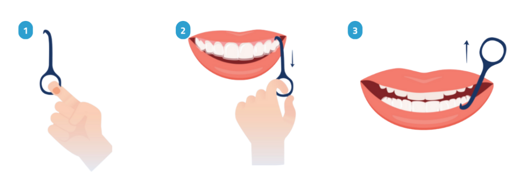 إزالة التقويم الشفاف