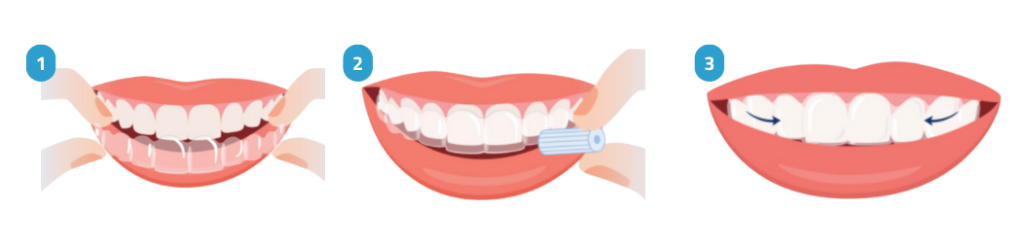 تركيب التقويم الشفاف