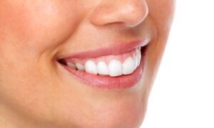 تجميل-اللثة - افضل عيادة اسنان في المنصورة - دكتور محمد عبدالوهاب السعدني